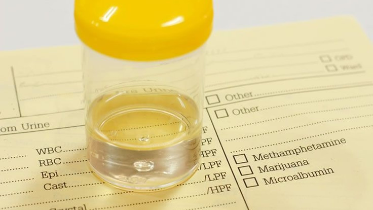 urine sample dilution for a drug test